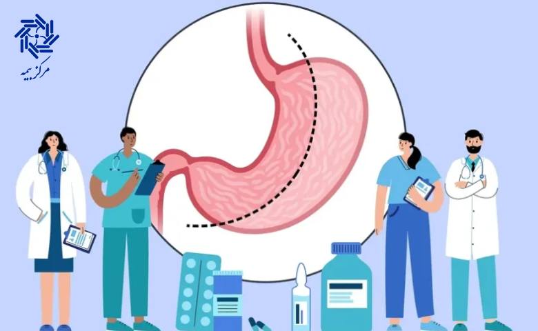 مقایسه هزینه عمل اسلیو معده با بیمه پایه 